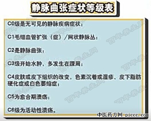 静脉曲张等级表