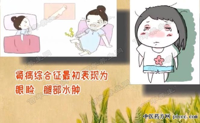 肾病综合征的临床表现