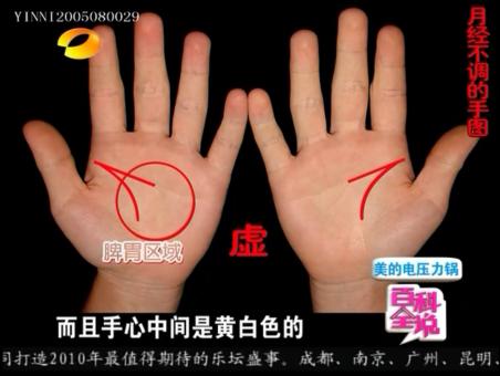 百科全说王晨霞细说女人病视频