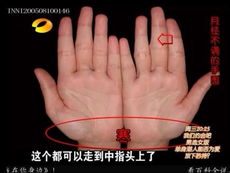 百科全说王晨霞细说女人病视频