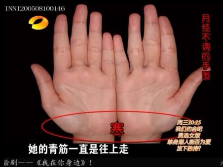 百科全说王晨霞细说女人病视频