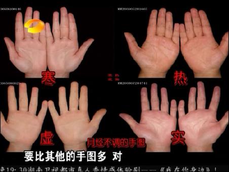 百科全说王晨霞细说女人病视频