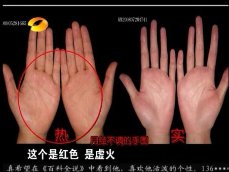 百科全说王晨霞细说女人病视频