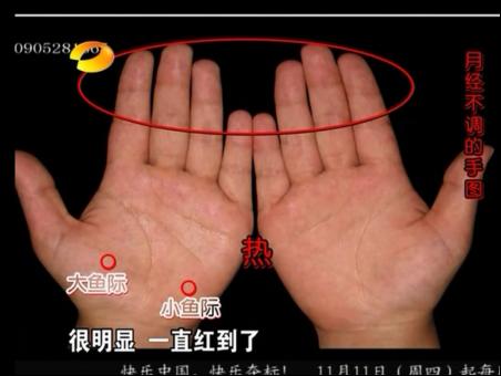 百科全说王晨霞细说女人病视频