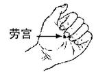 劳宫穴