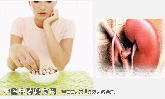 急性肾小球肾炎