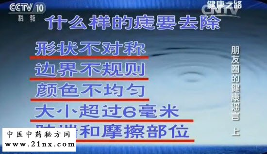 什么样的痣要去除