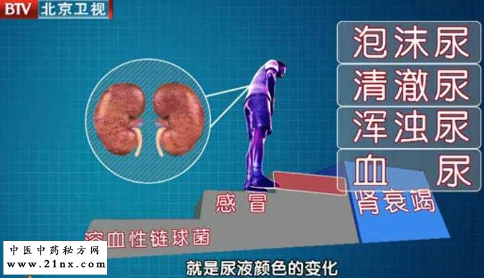 警惕夏天三种肾