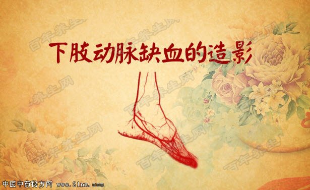 下肢动脉缺血造影