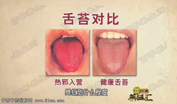 热邪入营证的表现