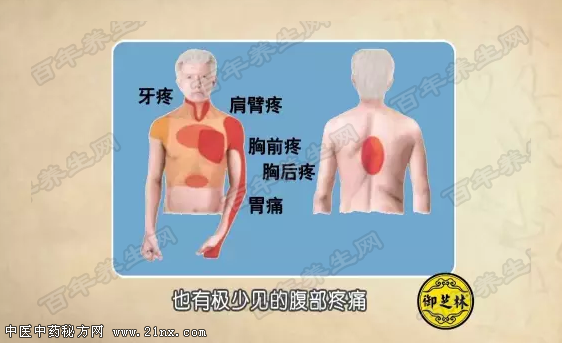 心绞痛痛在哪里