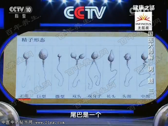 精子的不正常形态