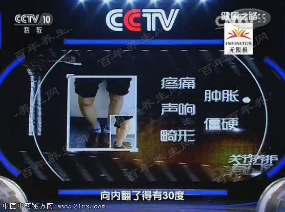 骨关节炎的表现