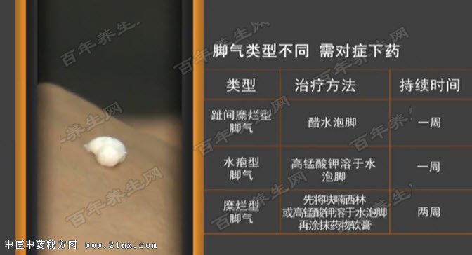 ½ÅÆøÀàÐͲ»Í¬ÖÎÁÆ·½·¨²»Í¬