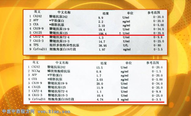 肿瘤标记物检查