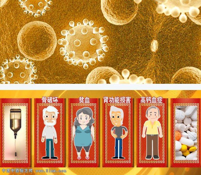 多发性骨髓瘤的4种典型症状