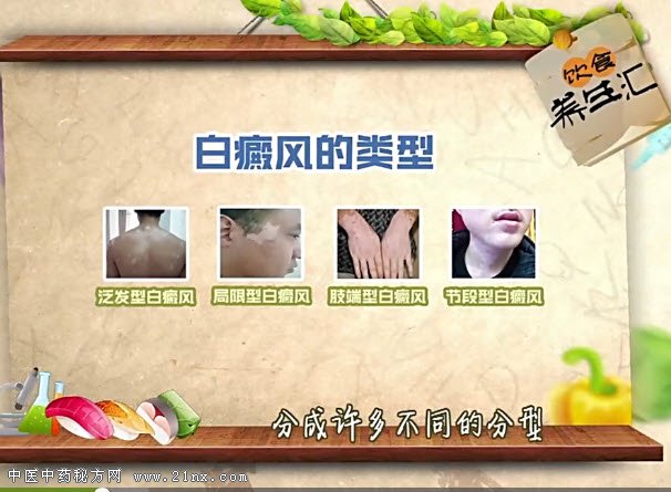 白癜风的类型