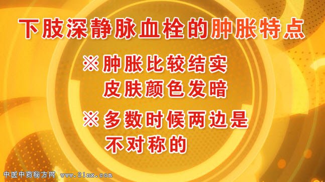 下肢静脉血栓的肿胀特点