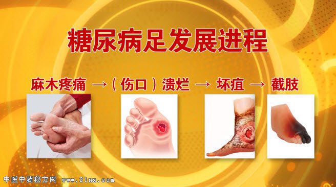 糖尿病足的发展过程