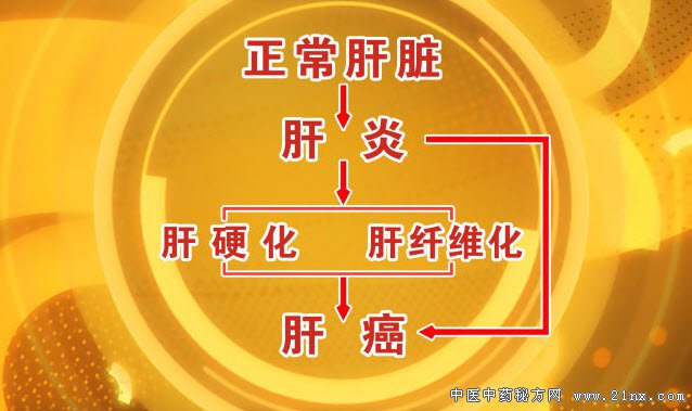 肝癌的演变过程