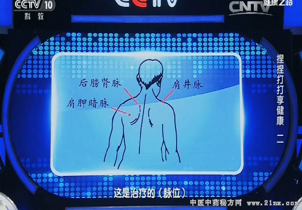 后膀肾脉、肩井脉、肩胛暗脉