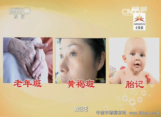 老年斑、黄褐斑、胎记
