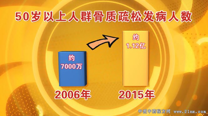 骨质疏松的发病人群