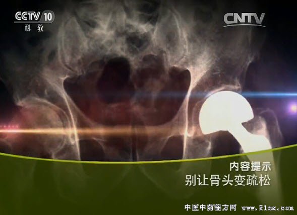 别让骨头变疏松