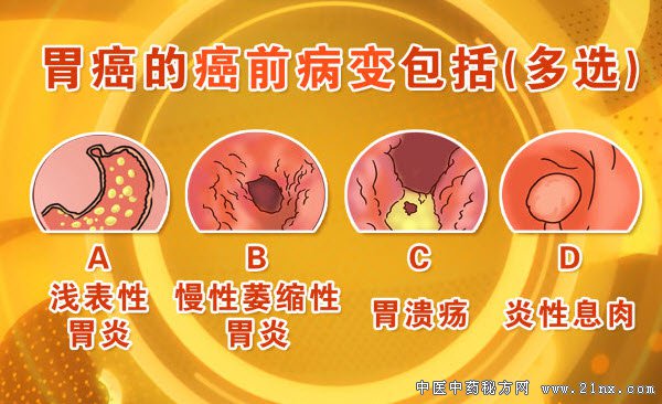 胃癌的检查方法哪个最准确