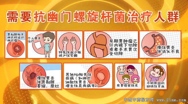需要治疗幽门螺杆菌的人群