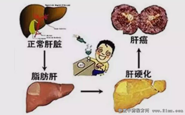 肝癌的演变过程