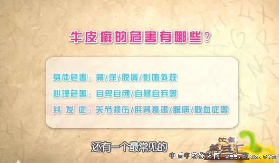 牛皮癣的危害