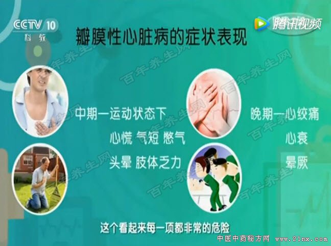 瓣膜性心脏病的症状