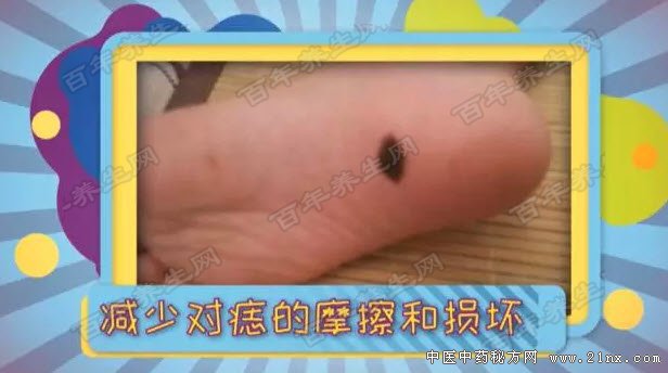 如何预防良痣恶变