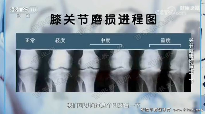 ϥ�ؽ�ĥ�����ͼ