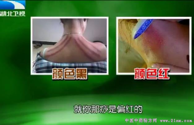 饮食养生汇20180201冯淬灵