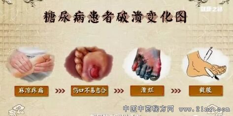 糖尿病患者破溃变化图
