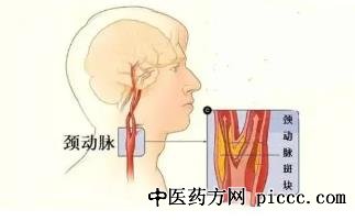 养生堂20220113:叶志东,腿疼,斑块,心脏堵塞,血脂异常,血管病变