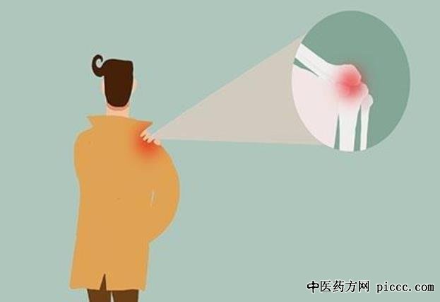 养生堂20230217:李琳,肺癌引起的骨痛,腰痛,胳膊痛,肋骨痛